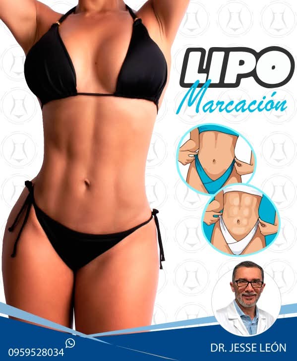 Lipo marcación de alta definición